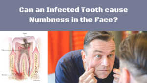 Featured image of an article on Can an Infected Tooth cause Numbness in the Face